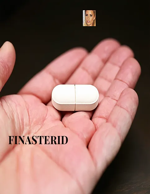 Achat finasteride propecia